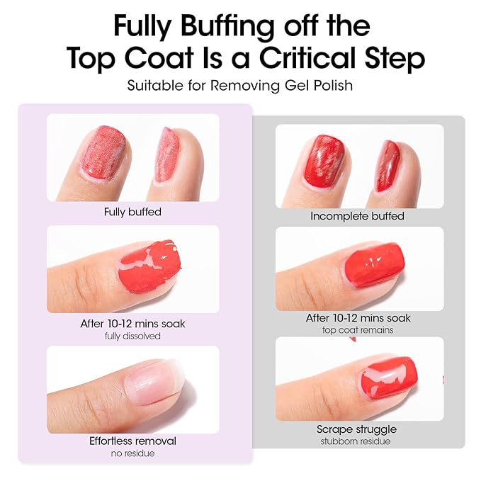 GELLEN Acetone Nail Polish Remover Pads, Professional Gel Polish Remover Pads, 200 Pack Travel Bulk Set with Tools, Individually Wrapped Quick & Effective Soak Off Remover for Salon Home